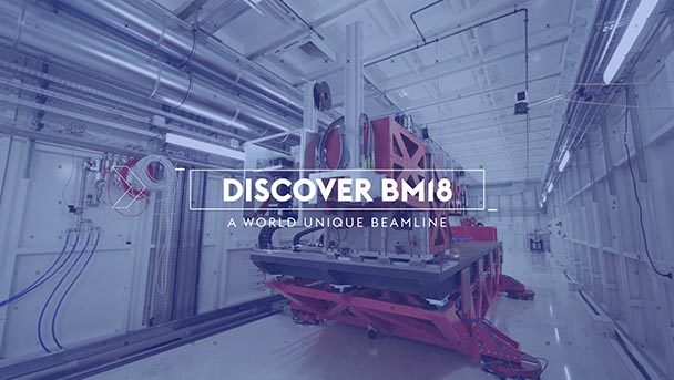 Vignette Discover BM18